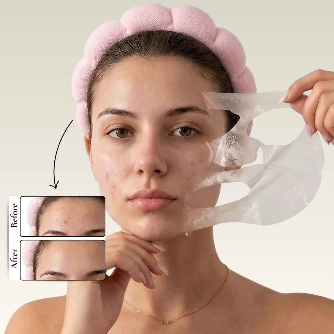 Full-Face Pimple Hydrocolloid Mask