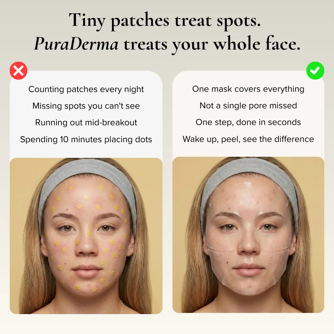 Full-Face Pimple Hydrocolloid Mask