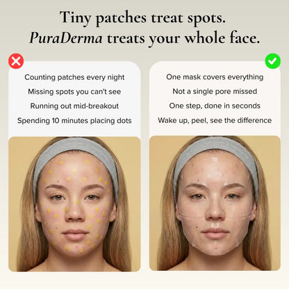 Full-Face Pimple Hydrocolloid Mask